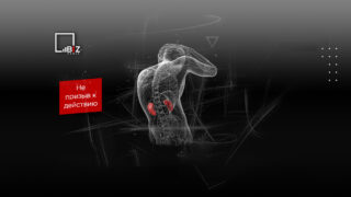 Сколько стоит почка человека — что будет, если ее продать?