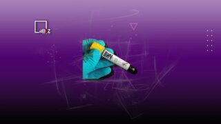 В Минздраве Казахстана не ожидают эпидемии ВИЧ из-за потока россиян