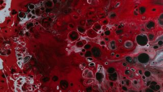 Ожирение может быть фактором риска развития рака крови, установили ученые