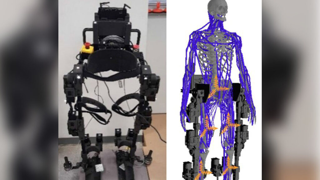 Фото: Luo S, et al. Journal of NeuroEngineering and Rehabilitation 20