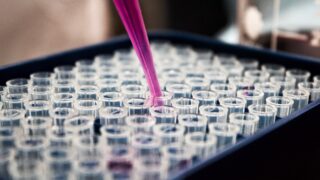 В двух районах Жамбылской области четыре человека заразились сибирской язвой