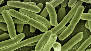 Лаборатория «ОЛИМП»: У четверти обследованных подтвердился бруцеллез