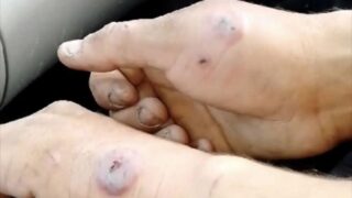 В соцсетях распространяются видео с пораженными сибирской язвой в Костанайской области