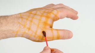 Миф или реальность: Йодная сетка и дефицит йода в организме