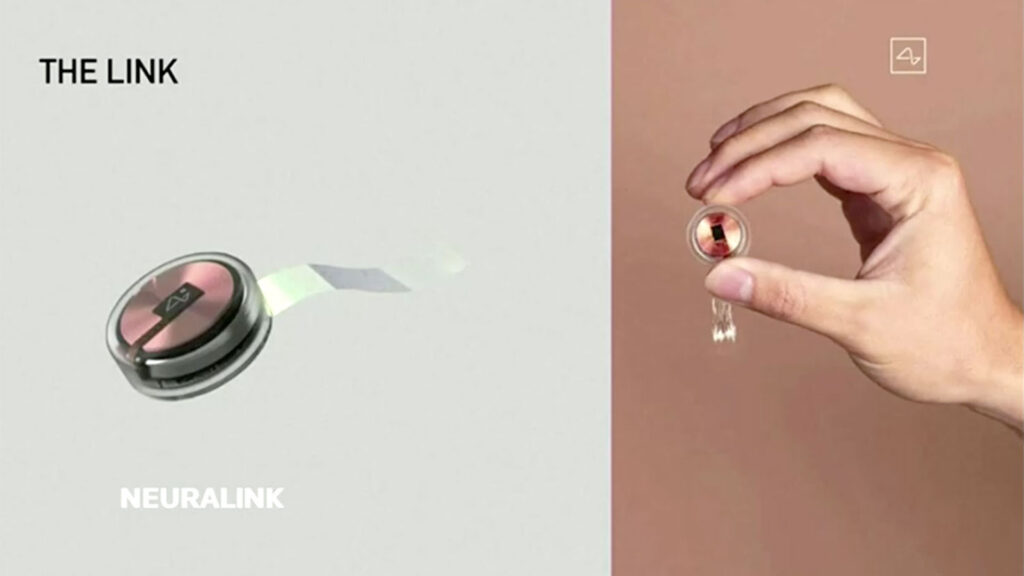 Фото: Neuralink