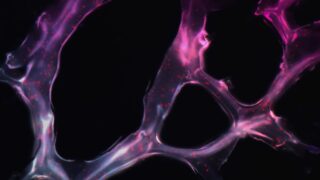 Открытие: новый подход к лечению рака поджелудочной железы — голодание раковых клеток