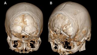 30-летнего строителя поразил выстреливший гвоздь, но ему удалось выжить