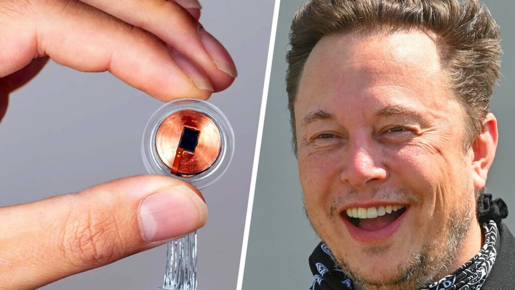 Фото: Neuralink/Global Look Press