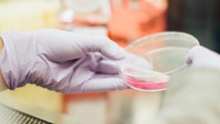 Найден вирус вызывающий рак крови