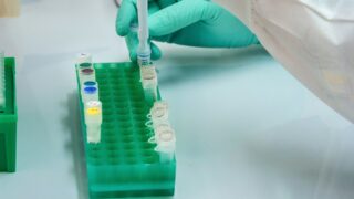 Ученые нашли причину возникновения псориаза