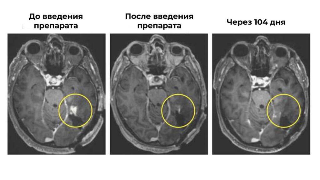 Фото: NEJM.