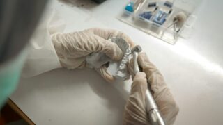 Минздрав не пересмотрит запрет на снятие денег из ЕНПФ на зубы — даже несмотря на критику